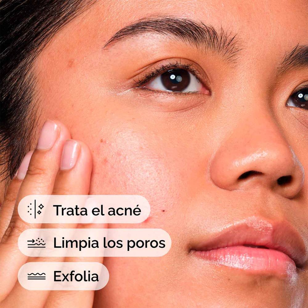 SALICYLIC ACID 2% SOLUTION (SUERO ANTI-IMPERFECCIONES CON ÁCIDO SALICÍLICO)